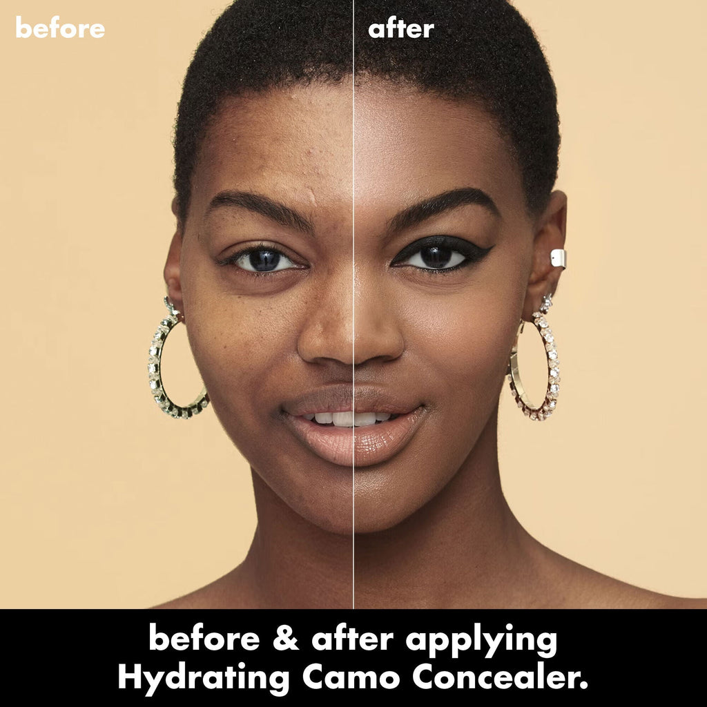 Before and After Comparison Applying Hydrating Camo Concealer