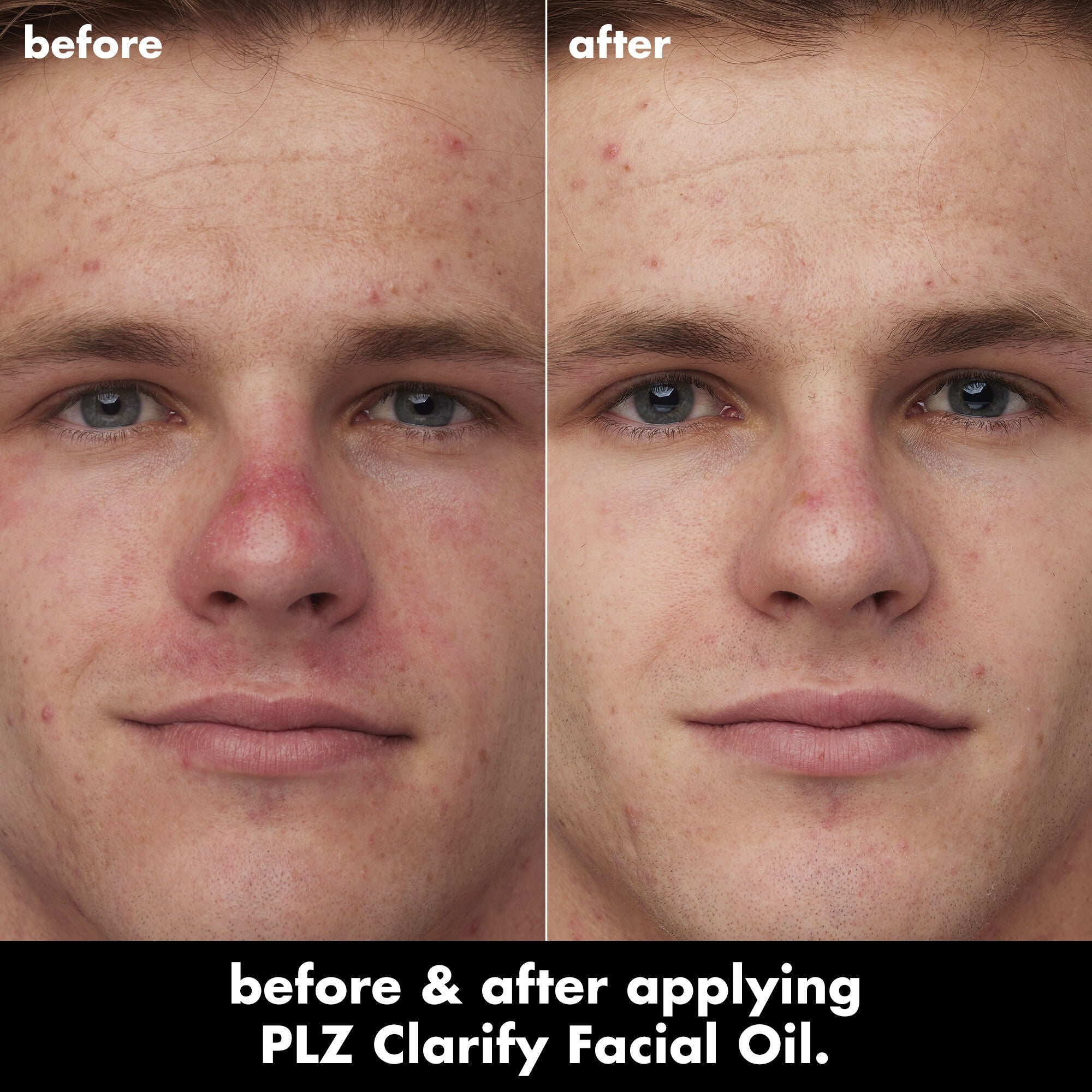 PLZ Clarify Facial Oil