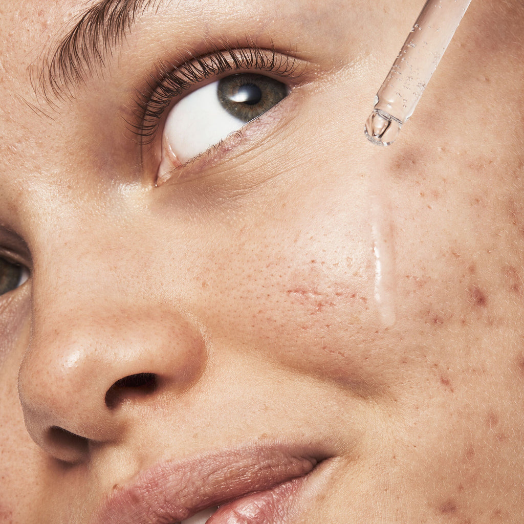Blemish Breakthrough Triple-acid Resurfacing Serum