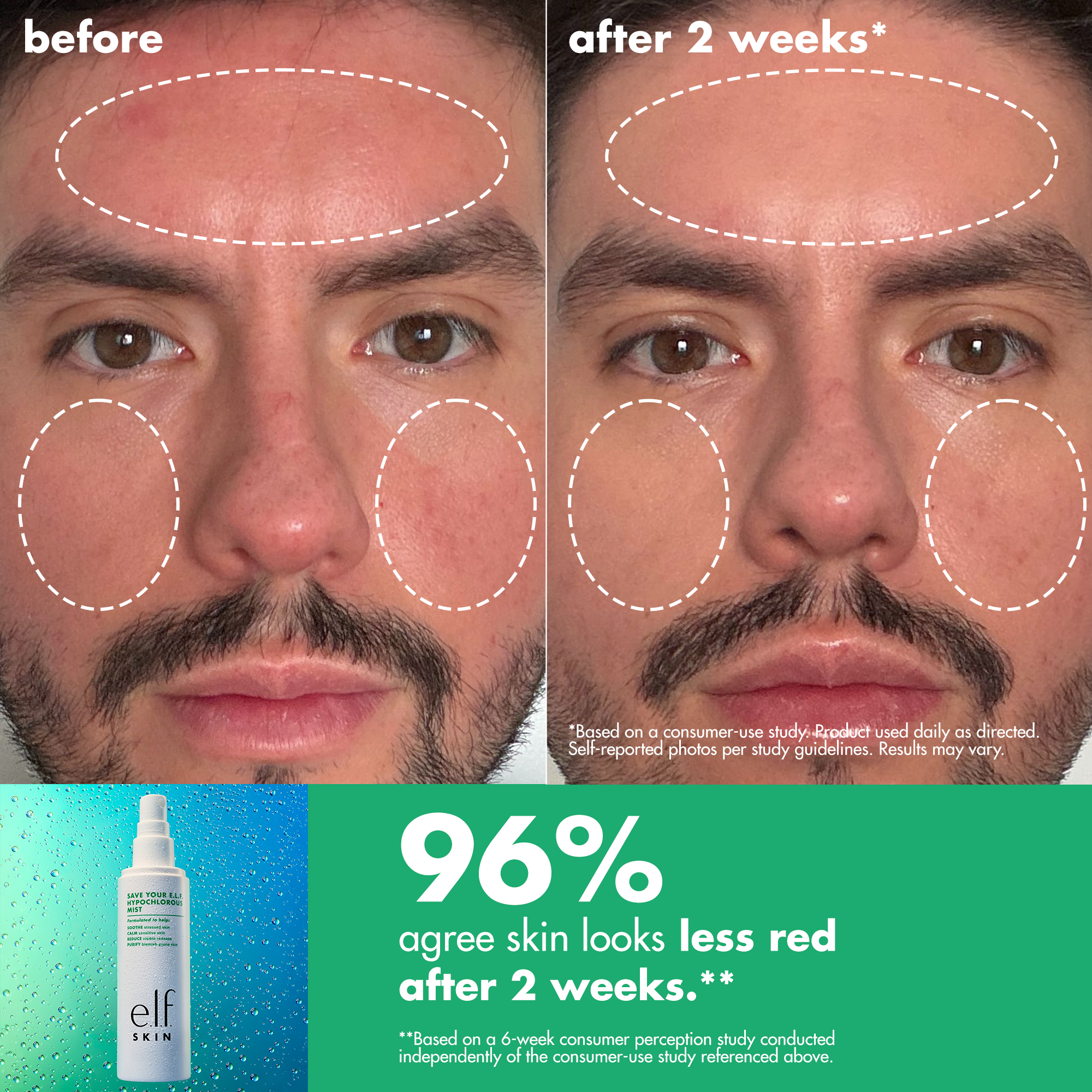 Clinically Proven: 96% agree skin looks less red after 2 weeks*
