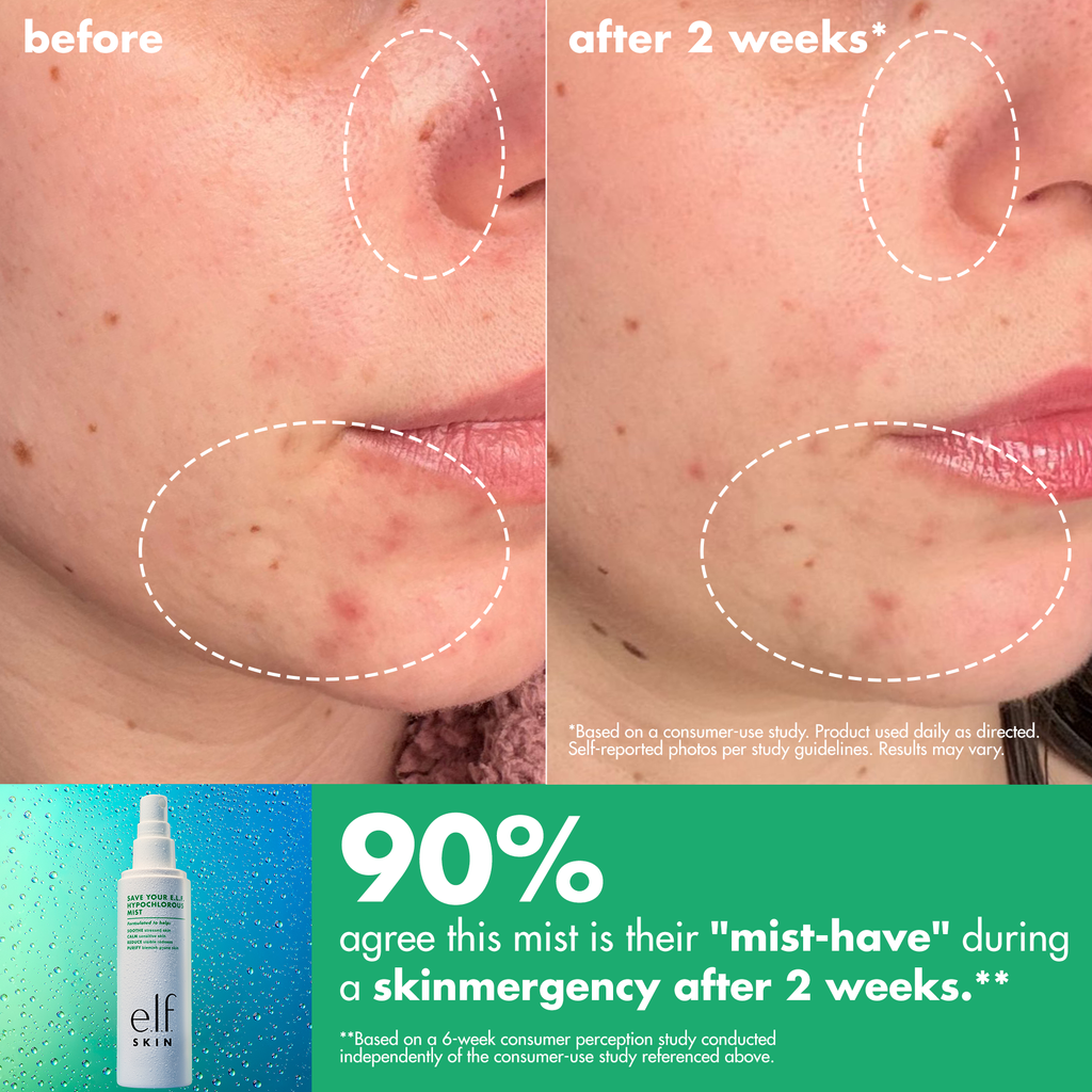 Before and After Results of Using e.l.f. Hypochlorous Mist After 2 Weeks